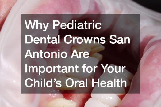 Why Pediatric Dental Crowns San Antonio Are Important for Your Child’s Oral Health